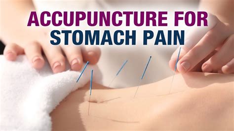 Acupuncture for Stomach Pain - Dr. Mayie Deshmukh - Holistic Acupuncture - YouTube