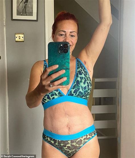 Sarah Cawood, 50, shows off her 'very neat' lumpectomy scars two weeks ...