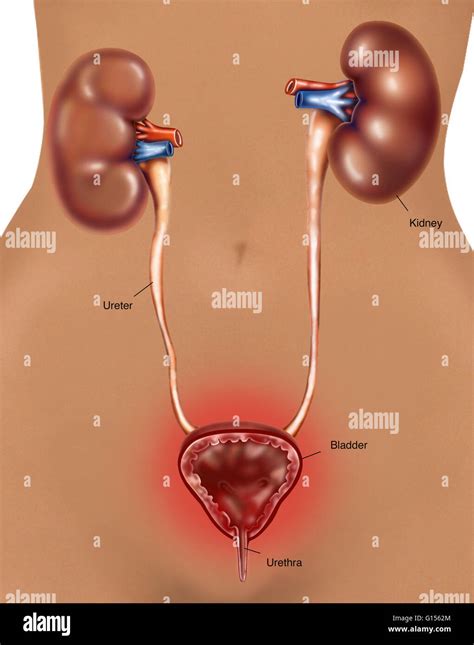 Urinary bladder diseases hi-res stock photography and images - Alamy