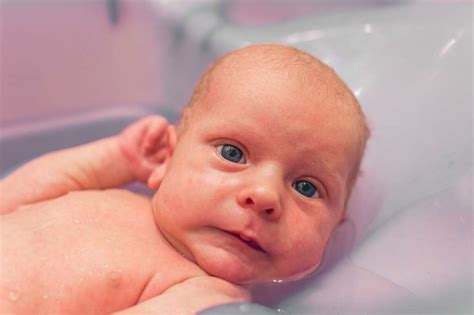 Heat Rash: Baby Heat Rash Symptoms, Causes & More