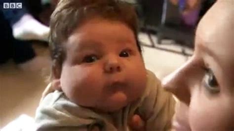 15-Pound Baby Defies Odds in Scary Birth - Good Morning America