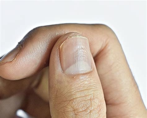 What Do Vertical Ridges on Fingernails Mean? - Organic Olivia ...