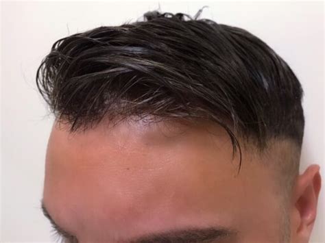 A Close Look at How Detectable Hair Piece for men Are