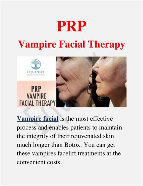 Vampire Facial Treatment