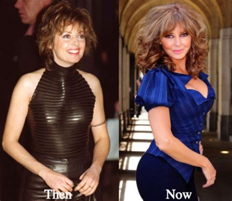 Carol Vorderman Plastic Surgery Before and After Photos - Latest ...