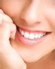 Métodos de blanqueamiento dental, Tipos de blanqueamiento dental