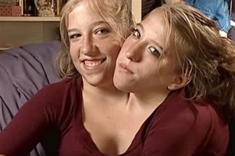 Conjoined Twins Share Huge News 22 Years After Their Birth — atraverslesport.com