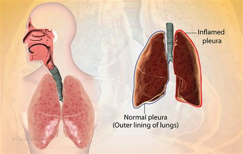 Health Condition : Symptoms, Causes, Treatment and More