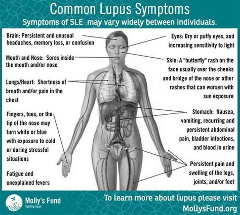 Lupus symptoms | Lupus symptoms, Lupus facts, Rheumatoid arthritis treatment