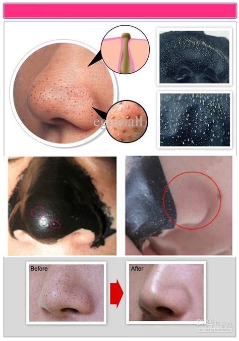 Beauty And Health: Blackheads Removing Mask | How to remove blackheads | Gelatin face mask ...