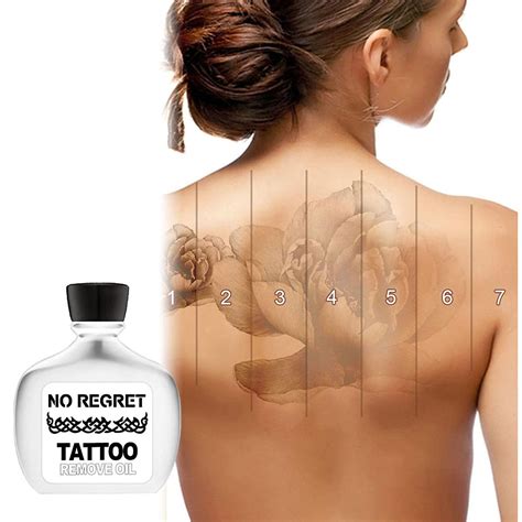 Buy Tattoos Removal Cream, Permanent Tattoos Removal, Tattoos Remover ...