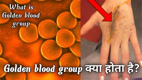 Golden Blood Group Kya Hai | What Is Golden Blood | Blood Group | In Hindi | Go To Facts - YouTube