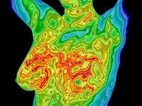 Breast Thermography - Advanced Thermal Imaging of West Michigan