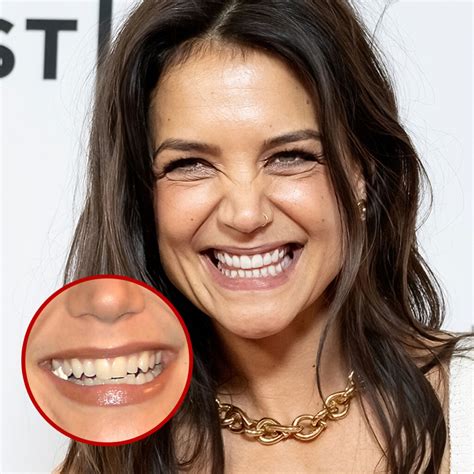 Celebrities With Crooked Front Teeth