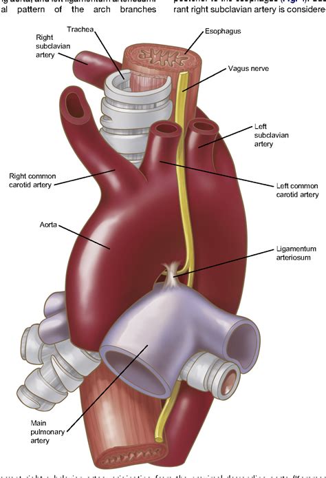 Anatomy Of The Thoracic Duct Thoracic Surgery Clinics - vrogue.co