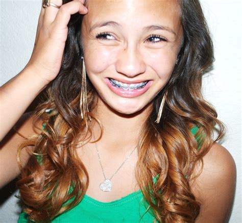 Braces smiling | Braces, Braces smile, Girl