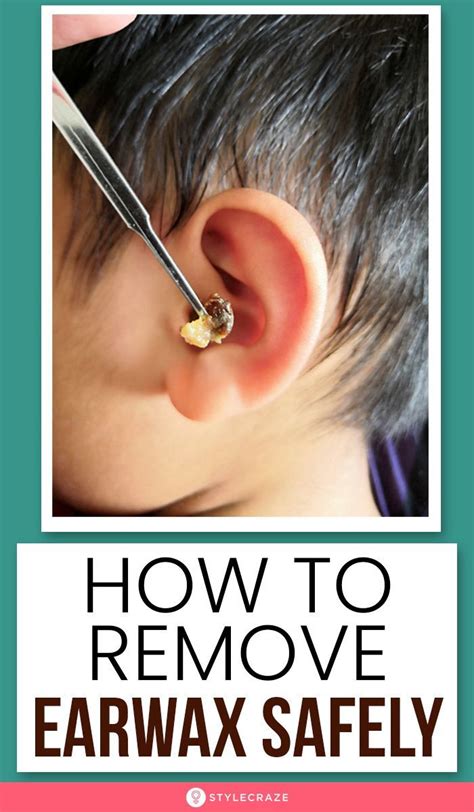 15 Effective Home Remedies To Remove Ear Wax Safely | Ear health, Clean ear wax out, Natural ...