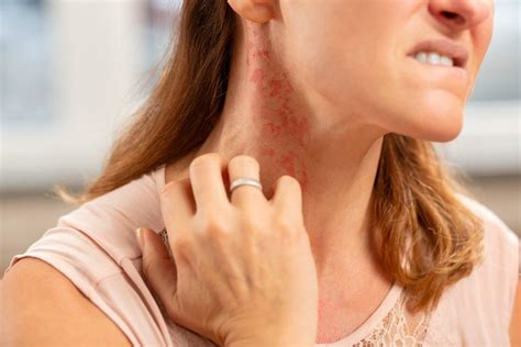 Allergic Reactions and Skin Rash - Aesthetic & Dermatology Center