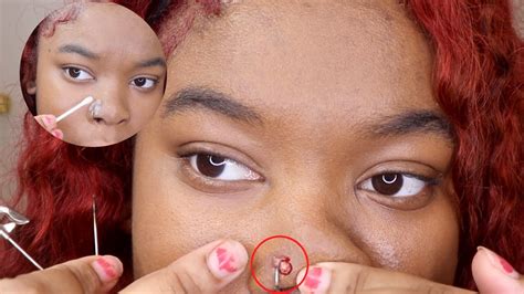 How to pop and Get rid of nose piercing bump (keloid) FAST - YouTube