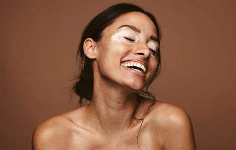 Vitiligo: Causes, Treatments, and More | POPSUGAR Beauty UK