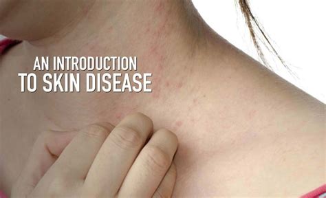 Skin Disorders: Types, Symptoms, Causes, Prevention & Treatment