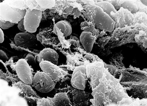 File:Yersinia pestis.jpg - Wikipedia