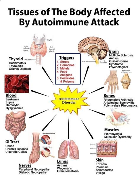 Psoriasis Diet - What is autoimmune disease ? Tissues of the Body ...