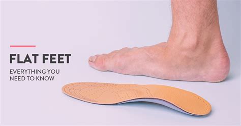 All About Flat Feet - Symptoms, Causes, Treatment Options and Exercises