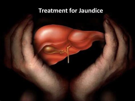 Causes and treatment methods for jaundice