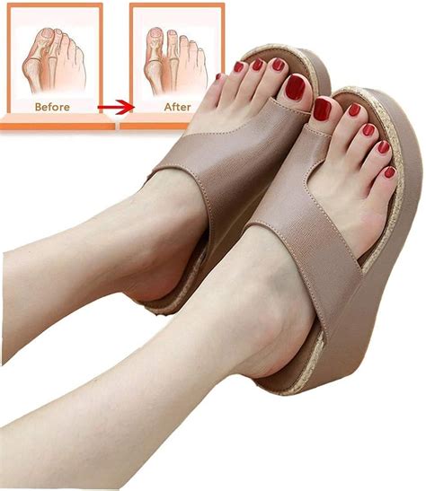 Best Sandals To Wear With Bunions | ist-internacional.com