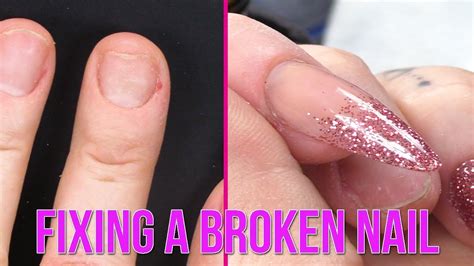 Aggregate more than 130 fix broken nail best - ceg.edu.vn