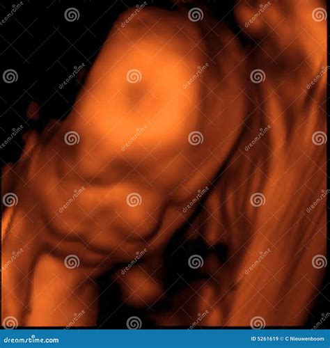 3D Sonogram stock image. Image of creation, motherhood - 5261619