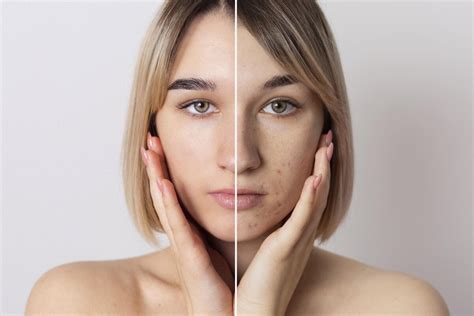 Dry Vs Dehydrated Skin; How to Tell the Difference | PECHE