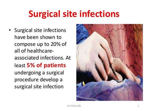 SURGICAL SITE INFECTIONSv PREVENTION AND CARE