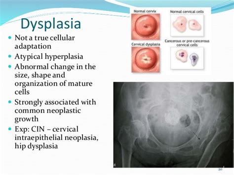 Basic Pathology : Introduction To Cells & Tissue Damage