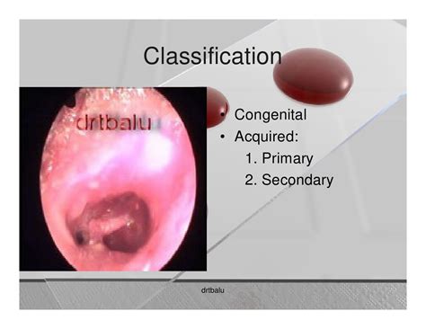 Cholesteatoma