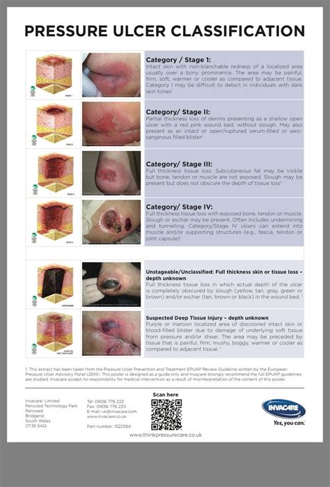 Pin by Cheryl Aaron on ED | Medical surgical nursing, Surgical nursing, Pressure ulcer