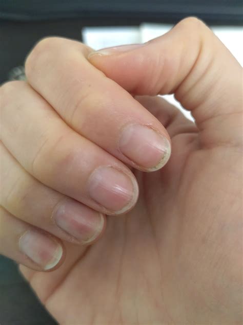 Why are my nails constantly dirty? : r/TheGirlSurvivalGuide