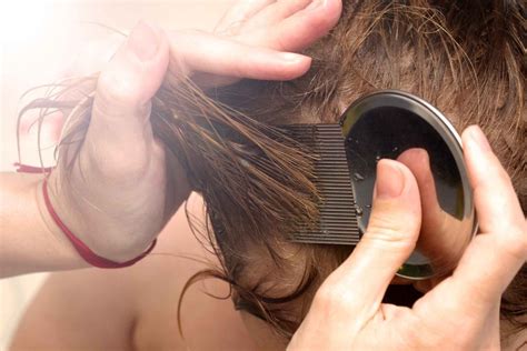 Head Lice Symptoms: 7 Things to Look For | The Healthy