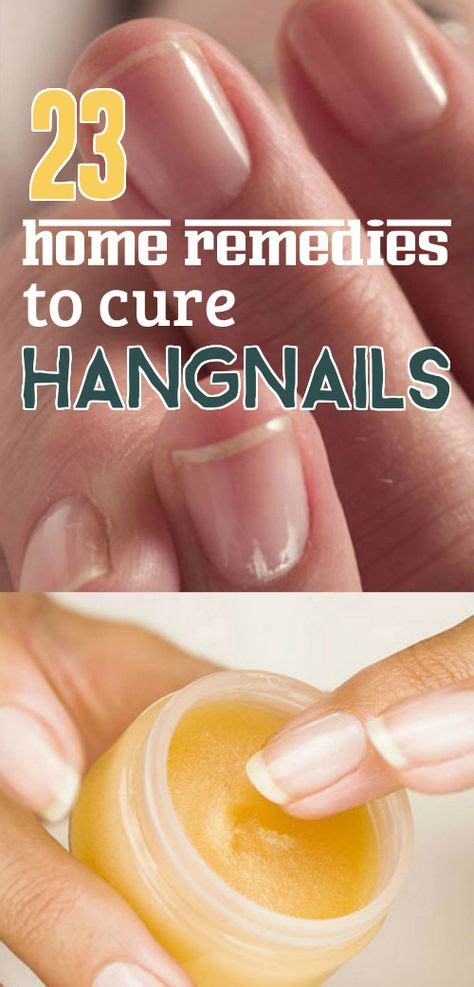 23 Effective Home Remedies to Get Rid of Hangnails | Hangnail, Nail ...