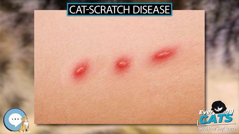 Cat Scratch Disease Causes, Symptoms And Treatment | vlr.eng.br