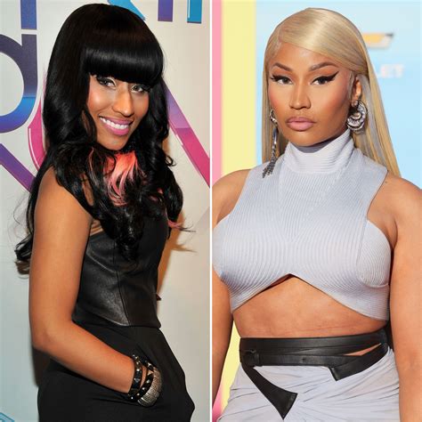 Nicki Minaj Plastic Surgery Before : Unveiling the Jaw-Dropping Transformation