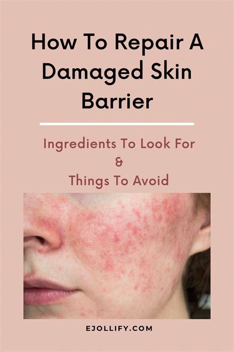 9 Tips on How To Repair Damaged Skin Barrier | Damaged skin repair, Skin repair, Skin facts