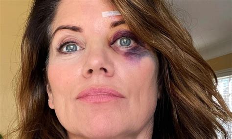 Fox 9 anchor Alix Kendall falls face first onto the top of a wrought ...