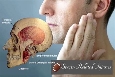 Sports-Related Injuries and TMJ Issues