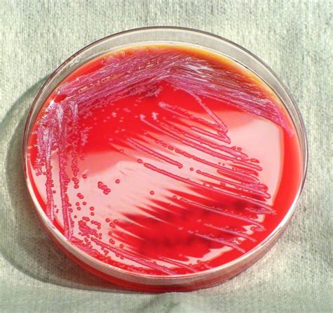 Serratia Marcescens Colony Morphology