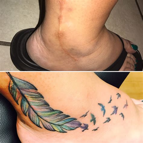 Scar cover up! | Tattoos to cover scars, Tattoo over scar, Scars tattoo cover up