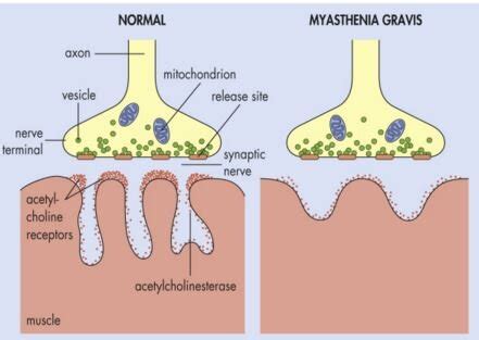 What is the molecular mechanism of tensilon? — Brain Stuff