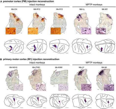 Frontiers | Cortical Projection From the Premotor or Primary Motor Cortex to the Subthalamic ...