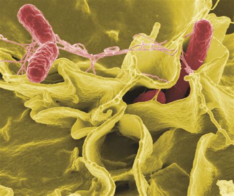 Bacterial Infections of the Gastrointestinal Tract · Microbiology